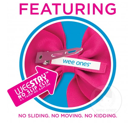 Medium Scalloped Edge Grosgrain Bow | Hot Pink